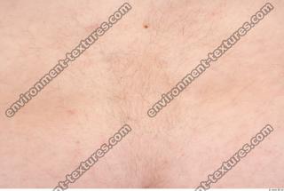 human skin hairy 0008